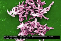 Clostridium difficile