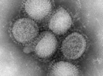 imagen del virus de la influenza H1N1