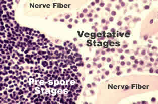 Heavy Hematodinium infection in the eye stalk of  the snow crab, Chionoecetes opilio.