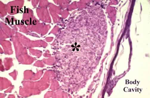 A heavy but focal microsporidian, Pleistophora sp., infection (asterisk) in the muscle of  juvenile walleye pollock.