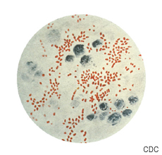 Photomicrograph of Yersinia (Pasteurella) pestis which causes plague in animals and humans