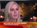 Good Morning America - Heidi Montag Talks About Her 10 Plastic Surgeries (01/19/2010)