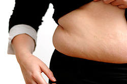 Overweight lady's exposed stomach with stretch marks