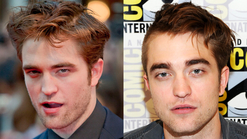 Dramatic Hair Transformations: RPatz Shaves Half of Head