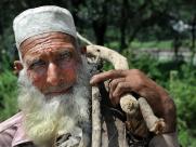 A Pakistani man at Jalozai camp