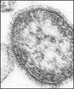 Microfotografía electrónica de barrido de un corte ultrafino (TEM) que revela los detalles ultraestructurales de una partícula sencilla, o "virión", del virus del sarampión. El virus del sarampión es un paramyxovirus, del género Morbillivirus. 