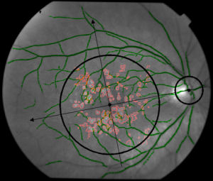 Characterized Retina