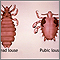 Head louse and pubic louse