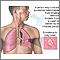 Tuberculosis of the lungs