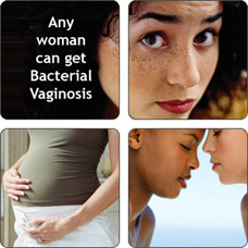 Montage of women. Any woman can get Bacterial Vaginosis.