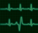 EKG image