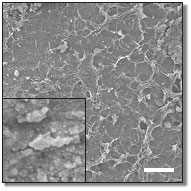 scanning electron micrographs of Raney-NiSn catalyst