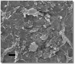 scanning electron micrographs of Raney-NiSn catalyst