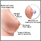 Breast self-exam