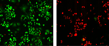 tumor cells