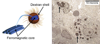 iron-centered nanoparticle and tumor cells