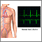 Normal heart rhythm