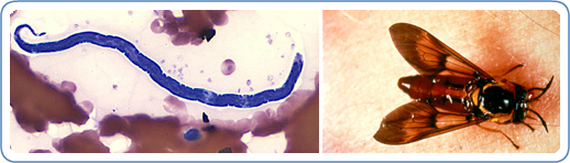 L: Microfilaria of L. loa in a thin blood smear, stained with Giemsa. R: Picture of Chrysops silacea feeding on a volunteer. 