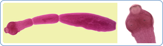 An image of an Echinococcus granulosus adult, and a close up of the scolex.