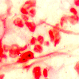 stain of haemophilus B 