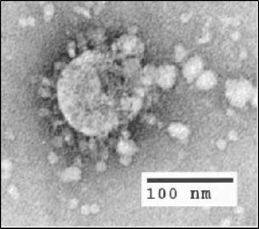 Image of the SARS Coronavirus