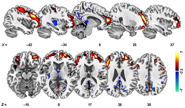 brain scans