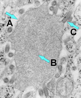 Electron microscope image of rabies virus budding from an inclusion into the endoplasmic reticulum in a nerve cell