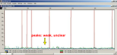 Still image linking to Animation Explaining an Inconclusive Result Using and Electropherogram