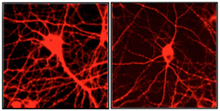 Microscope images of cultured rat neurons.