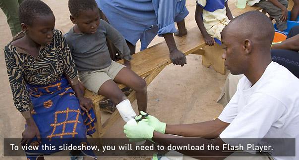 Health workers treat children for guinea worm, Tamale, Ghana.