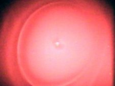 A vapor cloud forms around the heptanes fuel droplet following its dual-stage extinguishment in the FLEX investigation. (NASA)