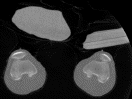 Specimen from the Visible Human Male - Thigh subset