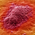 Image of a human colon cancer cell.