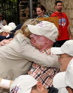 Photo:  A woman hugs a man wearing a ball cap.  He has severe burn scars on his face, ears, and hands.  