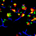 Microscope image of multicolored cells in a mouse pancreas. 