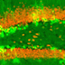 Microscope image shows bright green splotches near thick orange lines.