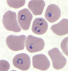 Rings of P. falciparum in a thin blood smear.