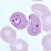 Trophozoites of P. ovale in a thin blood smear.