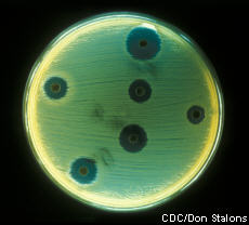 Photograph of Staphylococcus aureus cultured on an agar plate