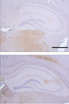 Constant Transmission Properties of Variant Creutzfeldt-Jakob Disease Cases from 5 Countries