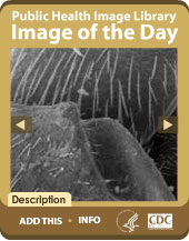  Public Health Image Library Image of the Day Widget. Flash Player 9 is required.