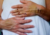 Injuries to a woman's hands and arm