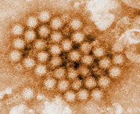 Norovirus