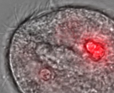 Photomicrograph of ciliate T. pyriformis during cell division with accumulated quantum dots appearing red.