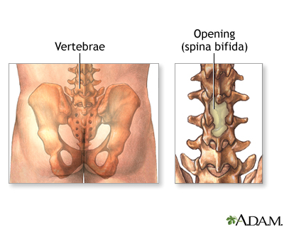 Normal anatomy