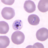 Caption would be schizont and ring form trophozoite of P. knowlesi in a thin blood smear.
