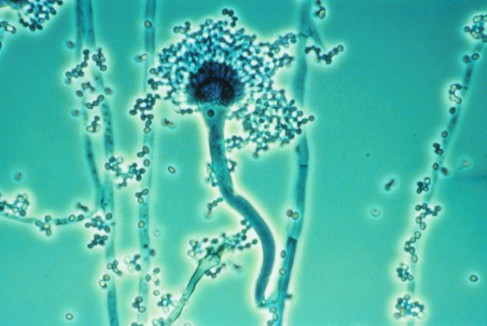 Image of Aspergillus Conidiophore and Conidia