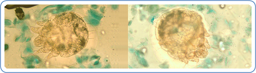 Sarcoptes scabiei mites in a skin scraping, stained with lactophenol cotton-blue.