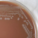 gram-negative burkholderia mallei bacteria grown on a medium of chocolate agar