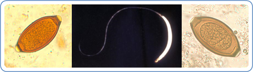 Left: Egg of T. trichiura in an iodine-stained wet mount. Right: Egg of T. trichiura in an unstained wet mount. Center: Micrograph of an adult female Trichuris human whipworm that is approximately 4cm long.